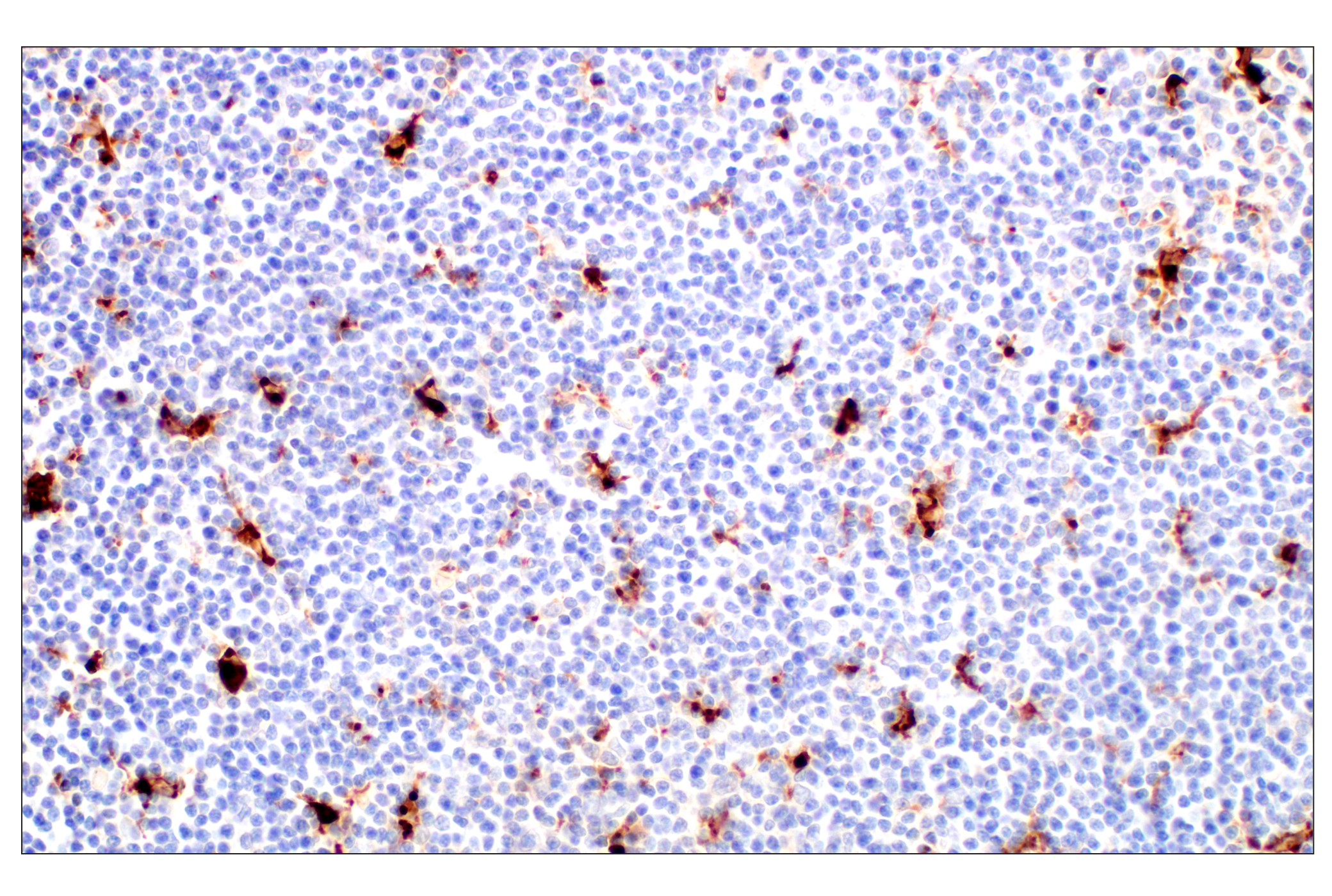 Immunohistochemistry Image 8: Cathepsin L (E3R3P) Rabbit mAb