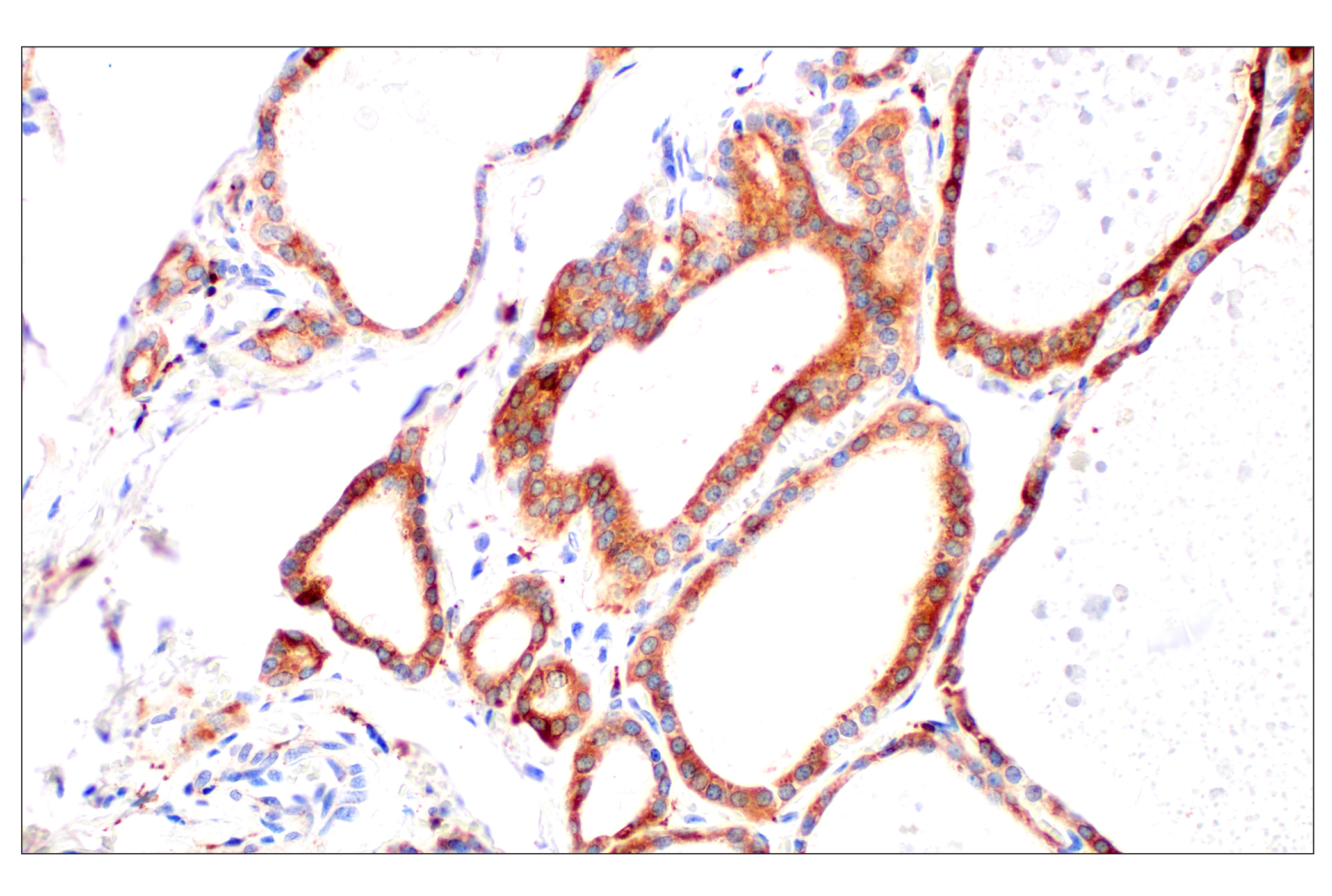 Immunohistochemistry Image 16: Cathepsin L (E3R3P) Rabbit mAb
