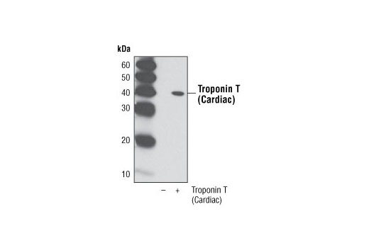 Western Blotting Image 1: Troponin T (Cardiac) Antibody