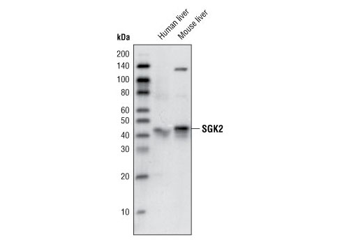 Western Blotting Image 1: SGK2 Antibody