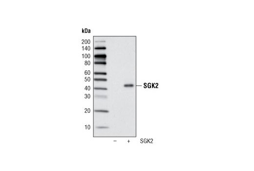 Western Blotting Image 2: SGK2 Antibody