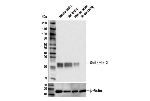 Western Blotting Image 1: Stathmin-2 Antibody