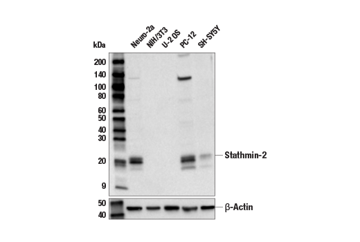 Western Blotting Image 2: Stathmin-2 Antibody