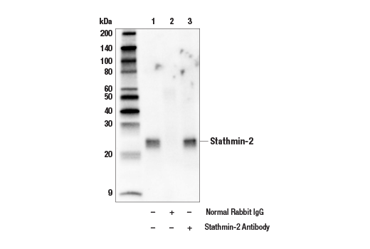 Immunoprecipitation Image 1: Stathmin-2 Antibody