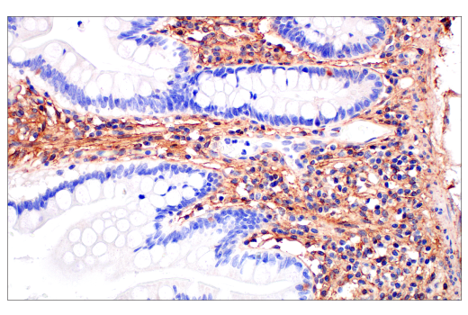 Immunohistochemistry Image 7: CD81 (D3N2D) Rabbit mAb