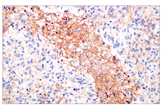 Immunohistochemistry Image 2: CD81 (D3N2D) Rabbit mAb