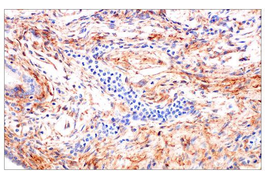 Immunohistochemistry Image 4: CD81 (D3N2D) Rabbit mAb