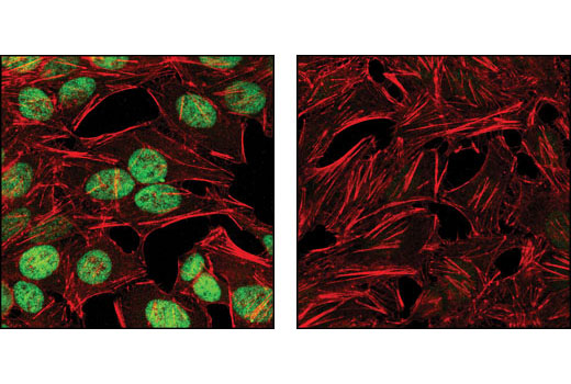  Image 31: Notch Activated Targets Antibody Sampler Kit