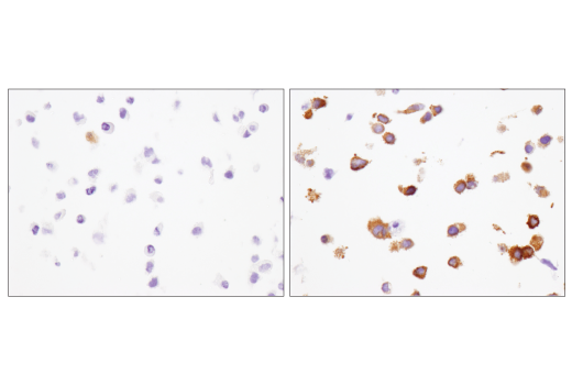 Immunohistochemistry Image 6: IFIT1 (D2X9Z) Rabbit mAb (BSA and Azide Free)