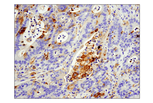 Immunohistochemistry Image 1: IFIT1 (D2X9Z) Rabbit mAb (BSA and Azide Free)