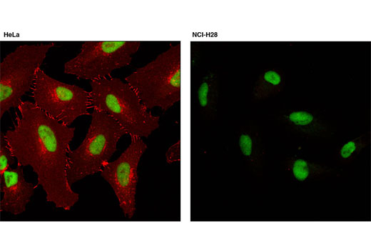 Immunofluorescence Image 1: β-Catenin (L54E2) Mouse mAb (Alexa Fluor® 555 Conjugate)
