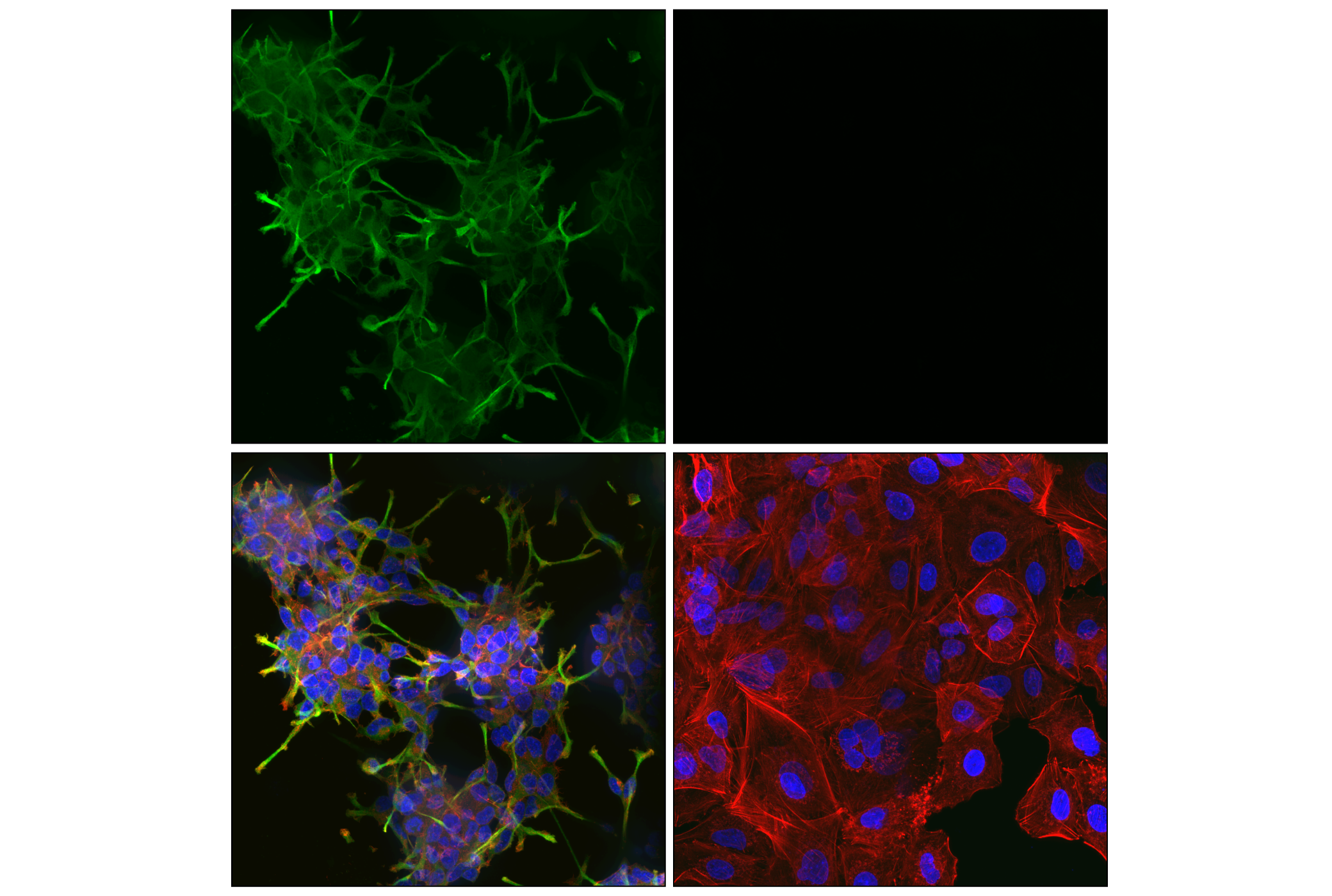 Immunofluorescence Image 3: Doublecortin (F6K9E) Rabbit mAb