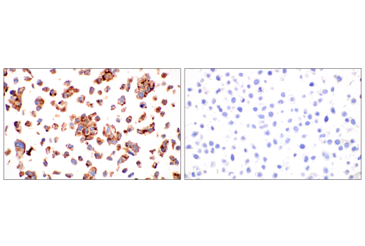 Immunohistochemistry Image 2: CYR61 (E5W3H) Rabbit mAb (BSA and Azide Free)