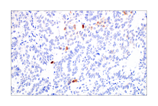 Immunohistochemistry Image 3: CYR61 (E5W3H) Rabbit mAb (BSA and Azide Free)