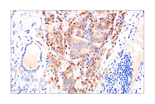 Immunohistochemistry Image 5: CYR61 (E5W3H) Rabbit mAb (BSA and Azide Free)