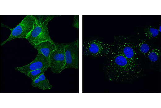 Immunofluorescence Image 1: EGF Receptor (D38B1) XP® Rabbit mAb (Alexa Fluor® 488 Conjugate)