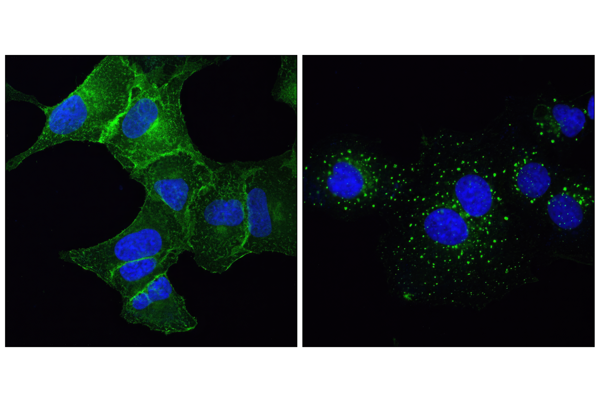 Immunofluorescence Image 1: EGF Receptor (D38B1) XP® Rabbit mAb (Alexa Fluor® 488 Conjugate)
