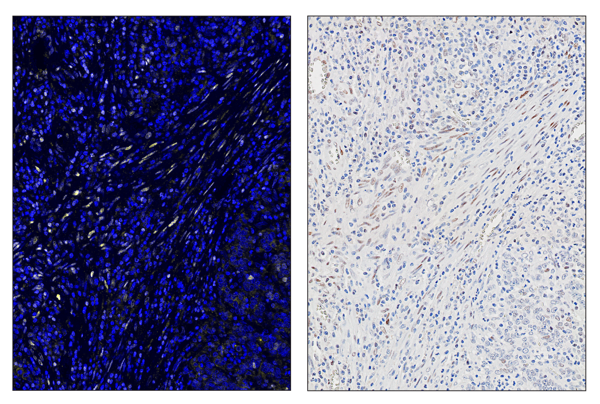 Immunohistochemistry Image 5: Phospho-Stat3 (Tyr705) (D3A7) & CO-0029-594 SignalStar™ Oligo-Antibody Pair