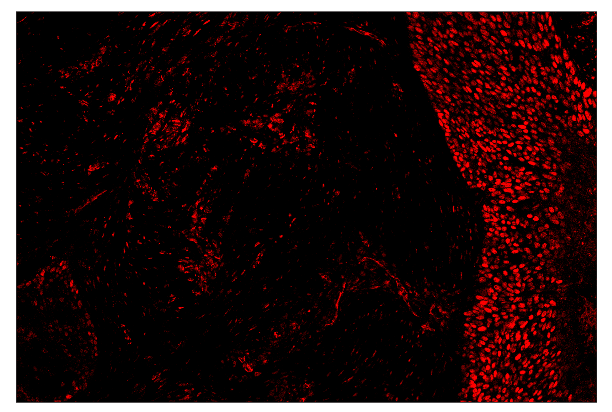 Immunohistochemistry Image 4: Phospho-Stat3 (Tyr705) (D3A7) & CO-0029-488 SignalStar™ Oligo-Antibody Pair