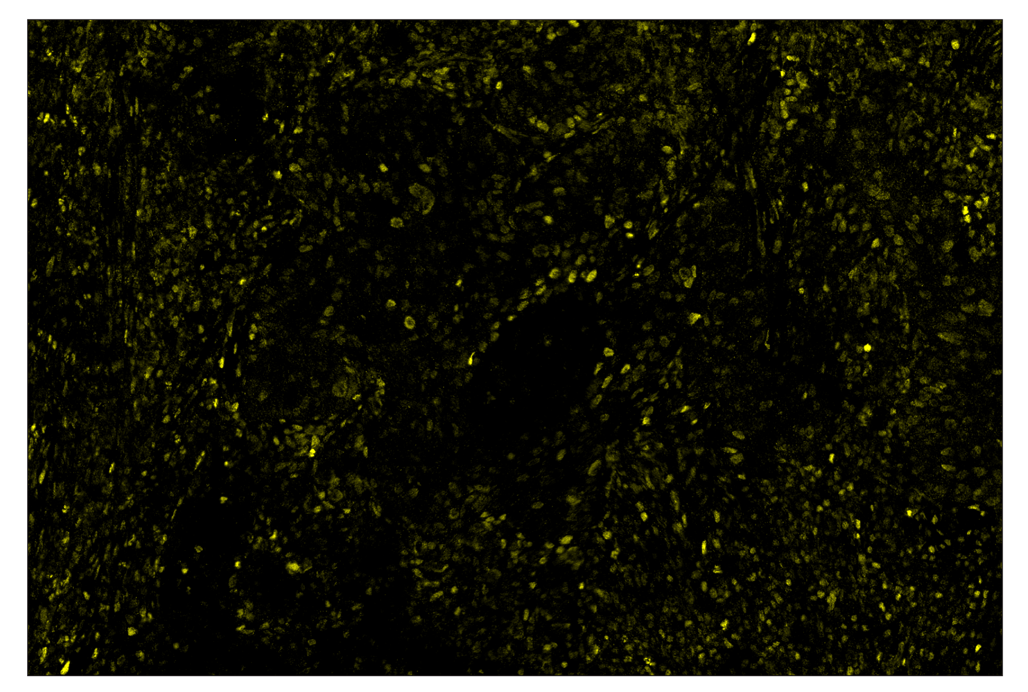 Immunohistochemistry Image 3: Phospho-Stat3 (Tyr705) (D3A7) & CO-0029-488 SignalStar™ Oligo-Antibody Pair