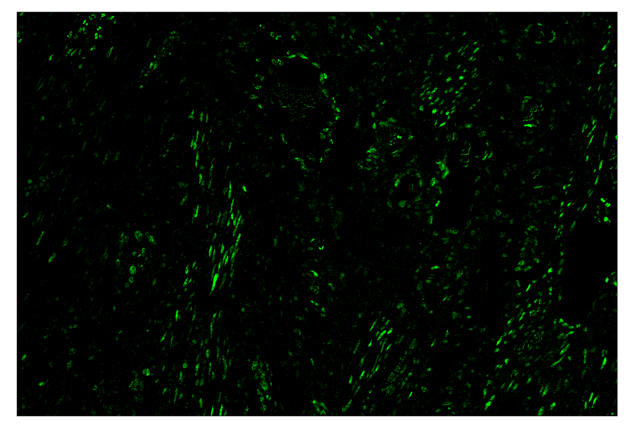 Immunohistochemistry Image 2: Phospho-Stat3 (Tyr705) (D3A7) & CO-0029-488 SignalStar™ Oligo-Antibody Pair
