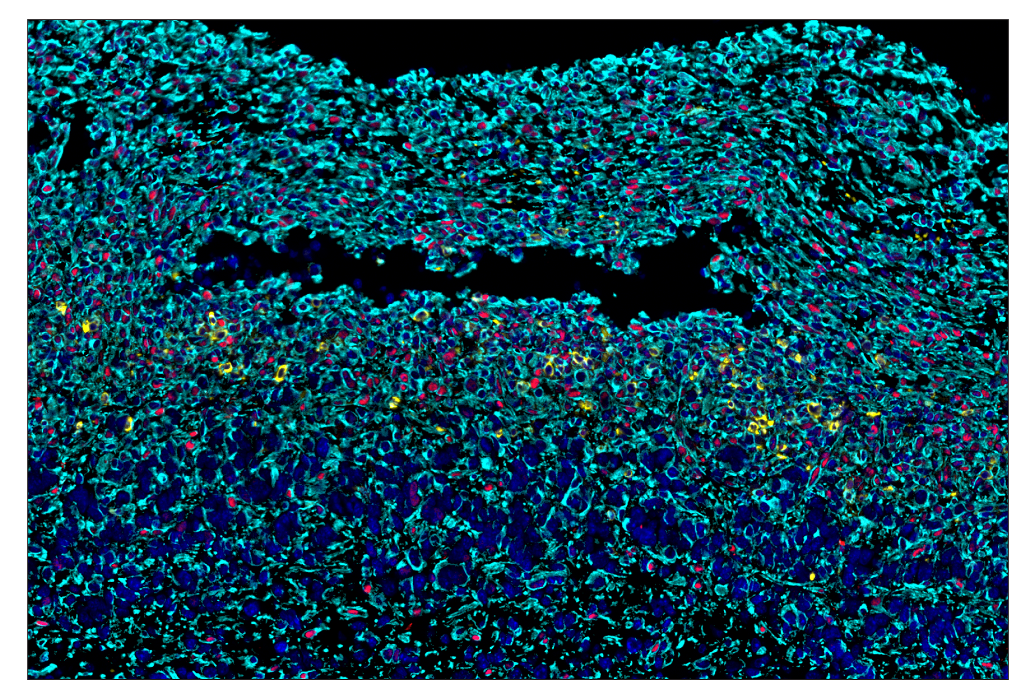Immunohistochemistry Image 6: Phospho-Stat3 (Tyr705) (D3A7) & CO-0029-488 SignalStar™ Oligo-Antibody Pair