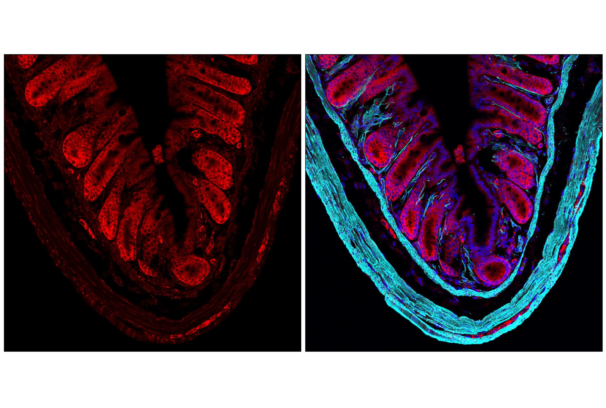 Immunofluorescence Image 1: S6 Ribosomal Protein (54D2) Mouse mAb (Alexa Fluor® 700 Conjugate)