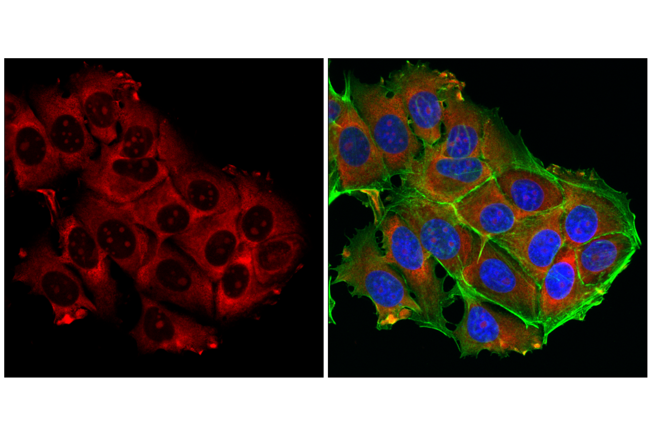 Immunofluorescence Image 3: S6 Ribosomal Protein (54D2) Mouse mAb (Alexa Fluor® 700 Conjugate)