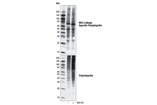  Image 4: Sequestosome Signaling Antibody Sampler Kit