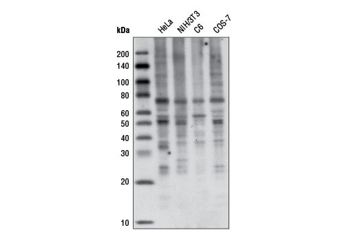  Image 21: Sequestosome Signaling Antibody Sampler Kit