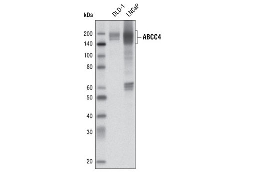 Western Blotting Image 1: ABCC4 Antibody