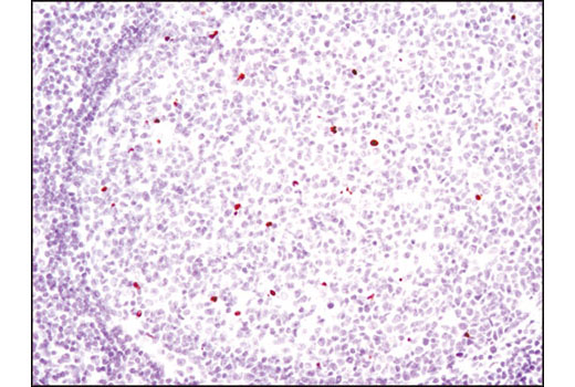 Immunohistochemistry Image 1: Cleaved PARP (Asp214) (D64E10) XP® Rabbit mAb