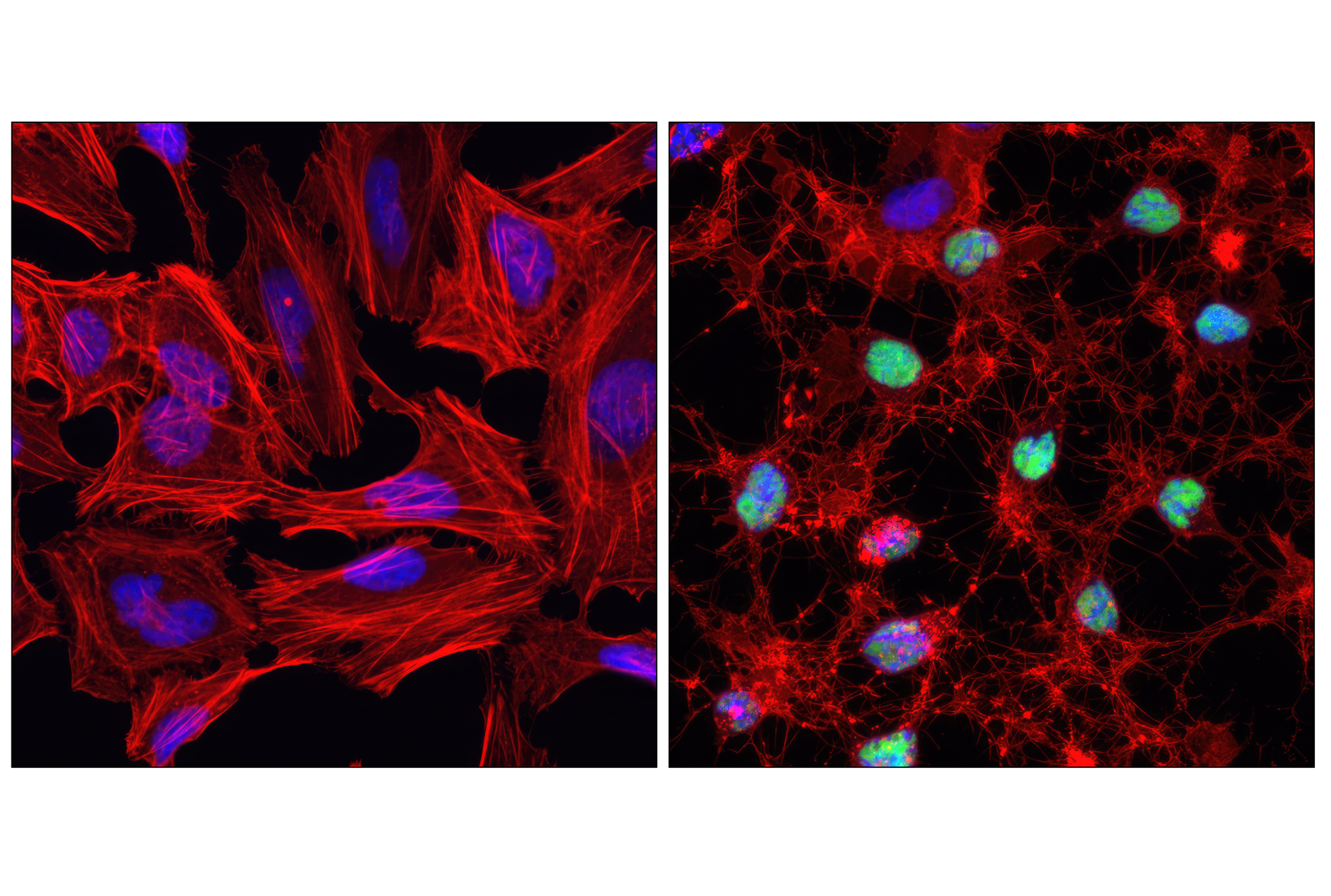 Immunofluorescence Image 1: Cleaved PARP (Asp214) (D64E10) XP® Rabbit mAb
