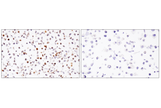 Immunohistochemistry Image 8: BCL6 (E5I8I) Rabbit mAb (BSA and Azide Free)