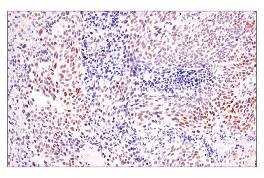 Immunohistochemistry Image 1: BCL6 (E5I8I) Rabbit mAb (BSA and Azide Free)