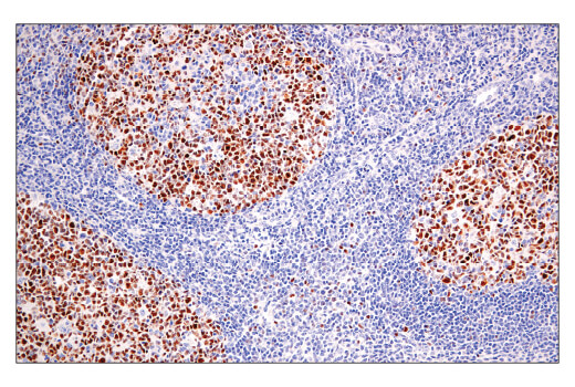 Immunohistochemistry Image 2: BCL6 (E5I8I) Rabbit mAb (BSA and Azide Free)