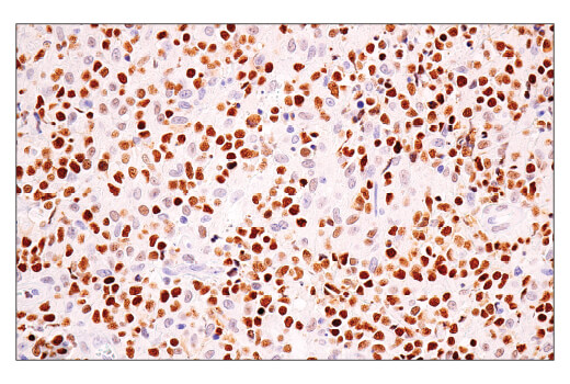 Immunohistochemistry Image 4: BCL6 (E5I8I) Rabbit mAb (BSA and Azide Free)