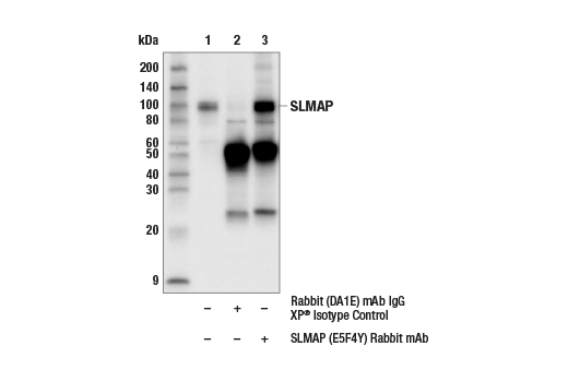Immunoprecipitation Image 1: SLMAP (E5F4Y) Rabbit mAb
