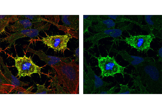 Immunofluorescence Image 1: CD44 (8E2) Mouse mAb