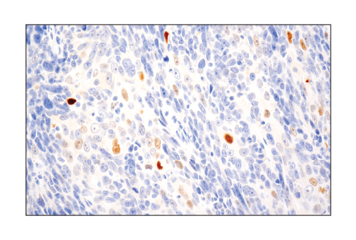 Immunohistochemistry Image 2: PRAME (E7I1B) Rabbit mAb