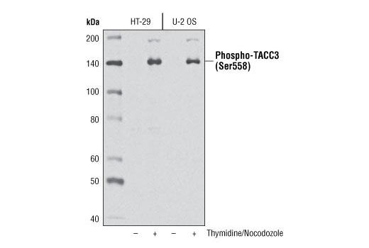 Western Blotting Image 1: Phospho-TACC3 (Ser558) Antibody