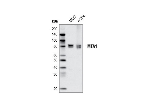  Image 6: NuRD Complex Antibody Sampler Kit