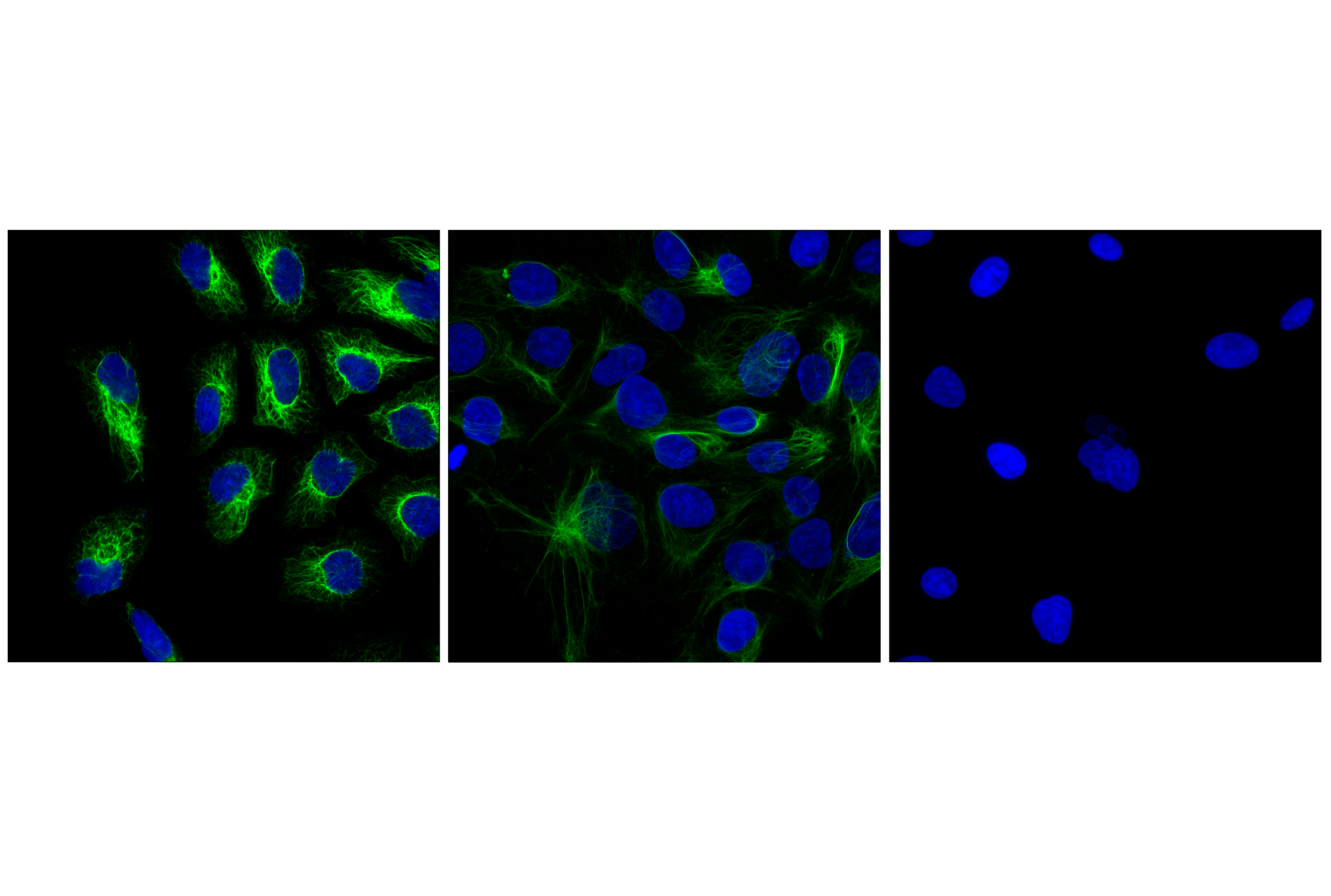 Immunofluorescence Image 3: Keratin 17/19 (D4G2) XP® Rabbit mAb (BSA and Azide Free)