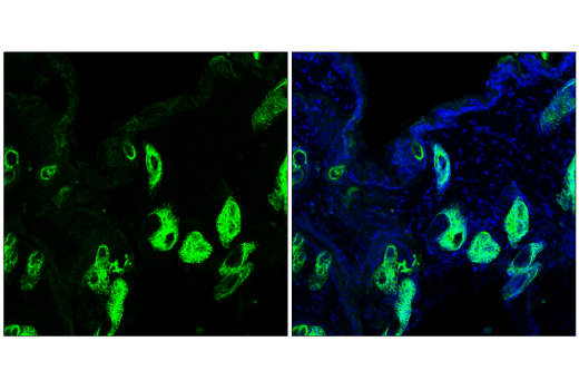 Immunofluorescence Image 1: Keratin 17/19 (D4G2) XP® Rabbit mAb (BSA and Azide Free)