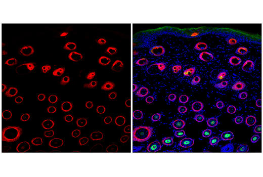 Immunofluorescence Image 2: Keratin 17/19 (D4G2) XP® Rabbit mAb (BSA and Azide Free)