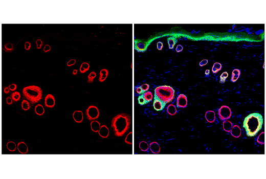 Immunofluorescence Image 2: Keratin 17/19 (D4G2) XP® Rabbit mAb (BSA and Azide Free)