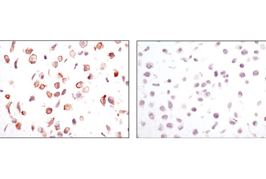 Immunohistochemistry Image 2: CA9 (D10C10) Rabbit mAb