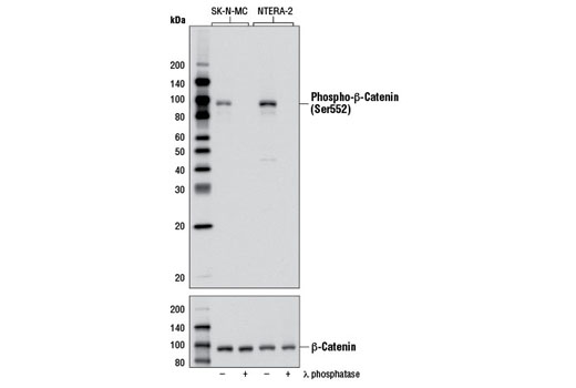 Image 4: β-Catenin Antibody Sampler Kit