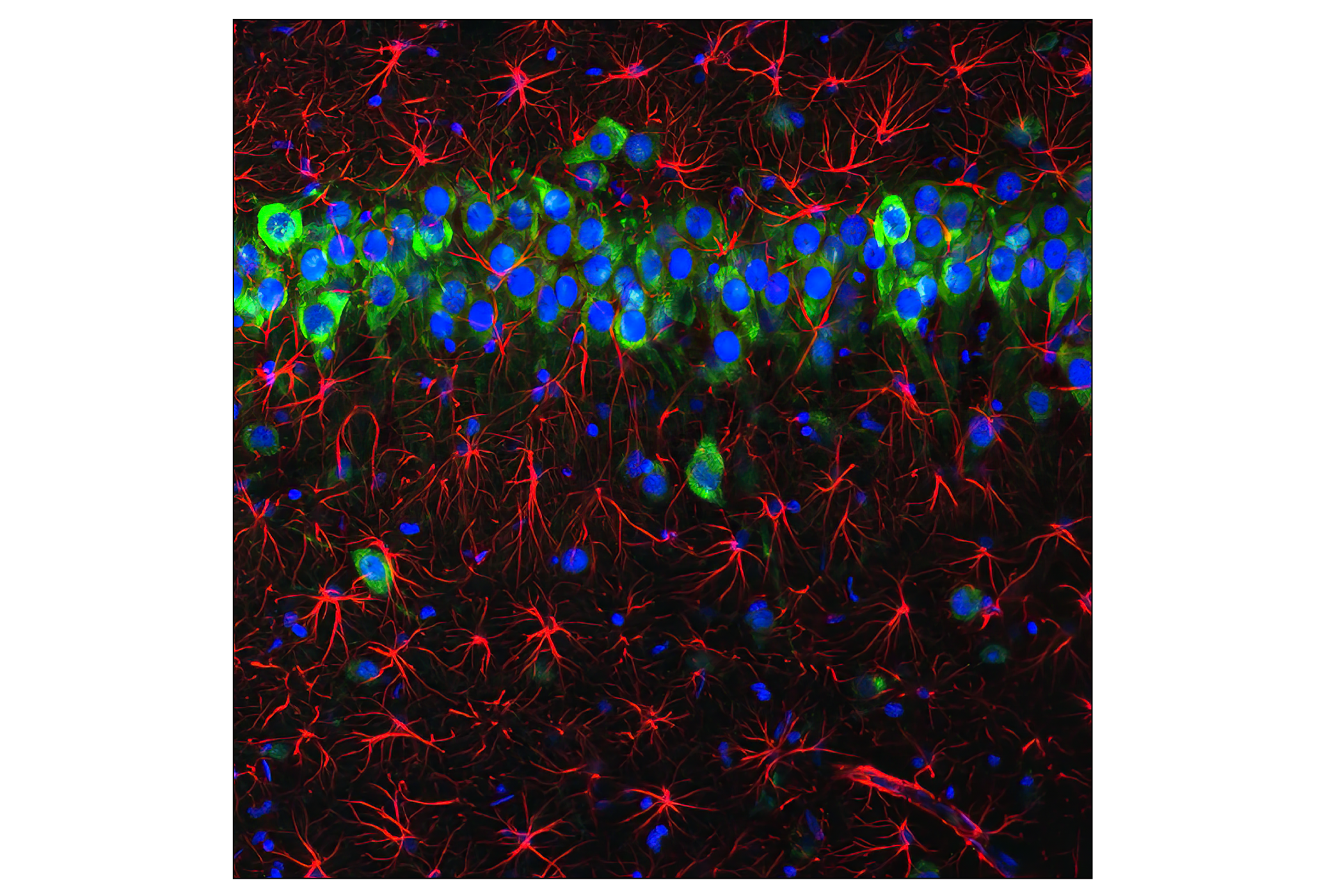 Immunofluorescence Image 1: GFAP (GA5) Mouse mAb (BSA and Azide Free)