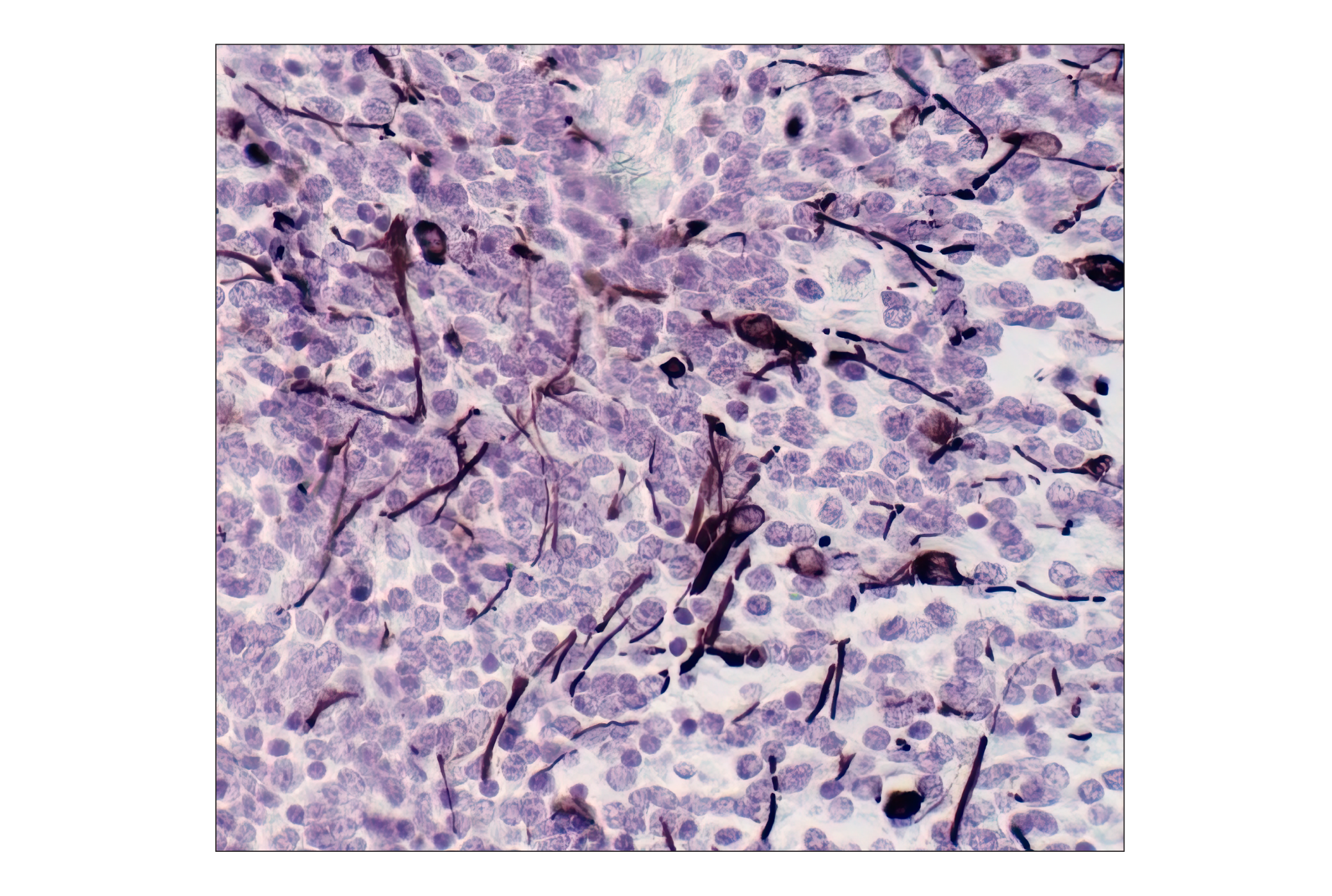 Immunohistochemistry Image 1: GFAP (GA5) Mouse mAb (BSA and Azide Free)